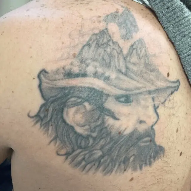 Photo 2 of Removery Tattoo Removal & Fading